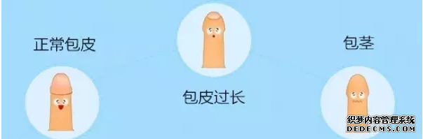 伊宁拜城县割包皮多少钱?诊疗一体,收费透明